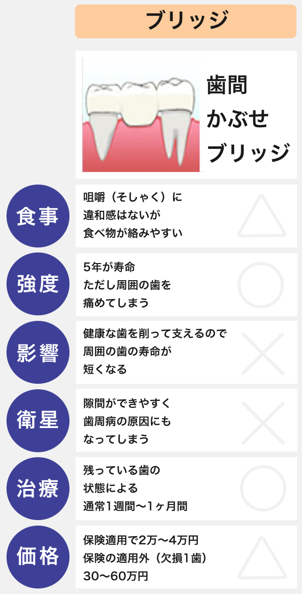 ブリッジ・入れ歯との違いについて