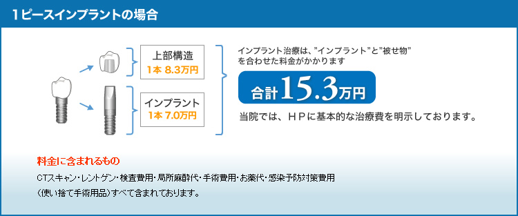 インプラントの料金の見かた