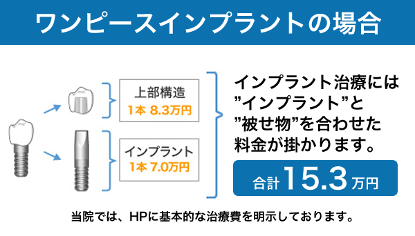 インプラントの料金の見かた