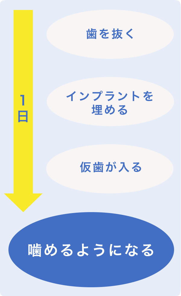 フルマウスインプラントの場合