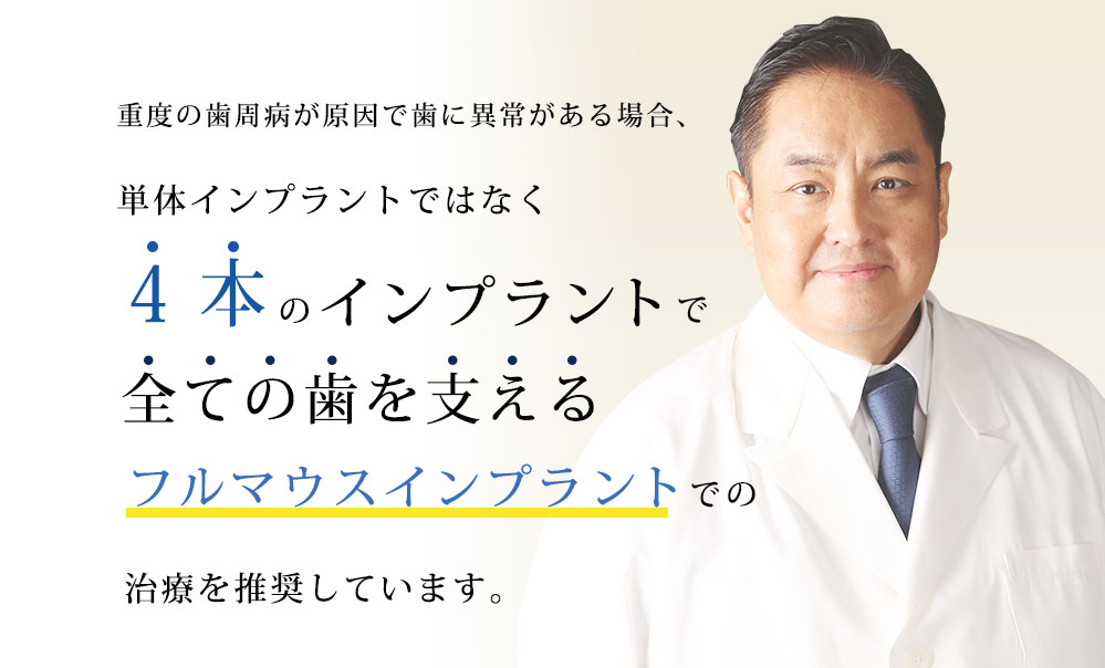 オールオン4（フルマウスインプラント）全ての歯を4本で支える治療