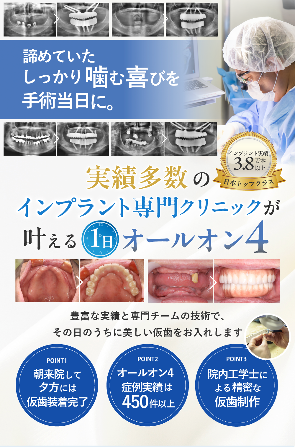 オールオン4（フルマウスインプラント）全ての歯を4本で支える治療