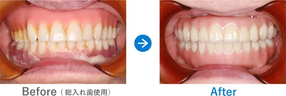症例a-3