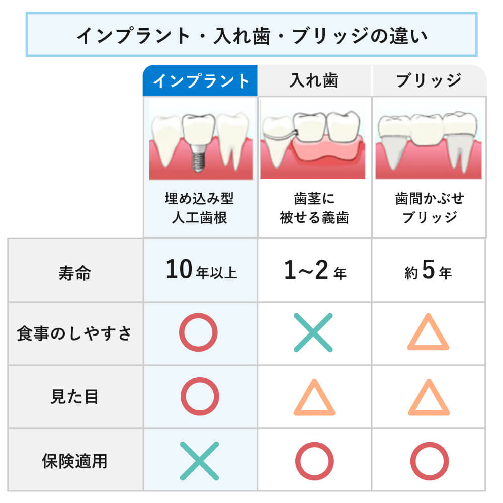 インプラント・ブリッジ・入れ歯の違い