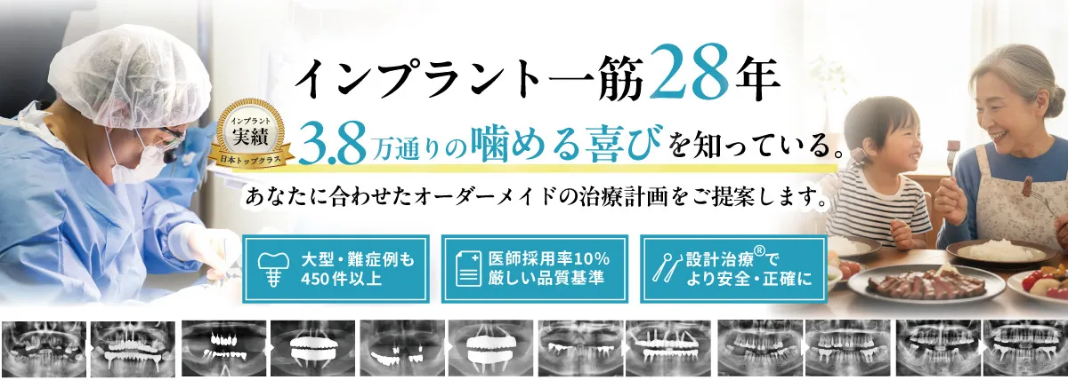 横浜でおすすめのインプラント名医ならアイデンタルクリニック