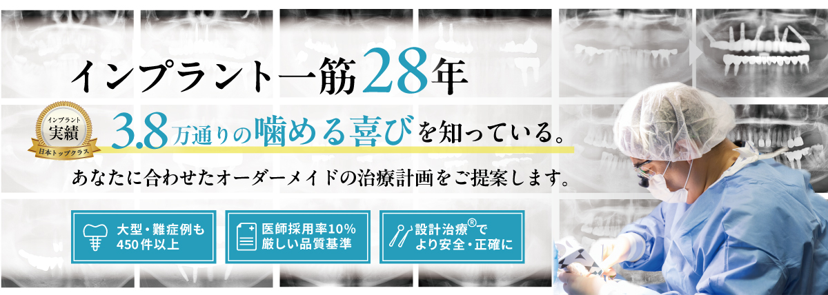 横浜でおすすめのインプラント名医ならアイデンタルクリニック