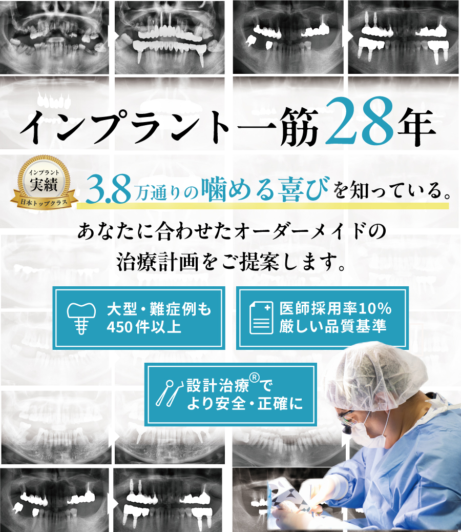 横浜でおすすめのインプラント名医ならアイデンタルクリニック