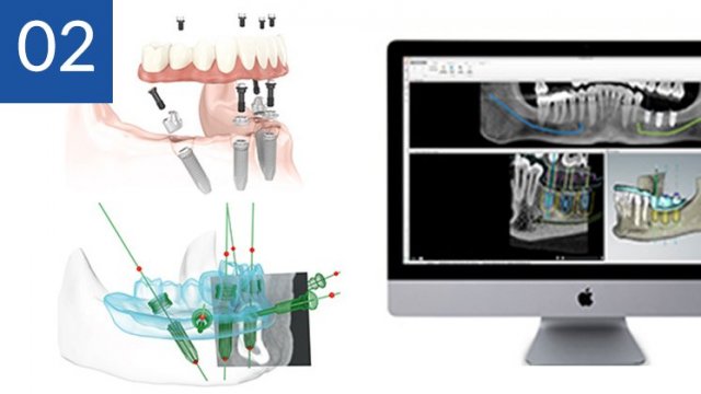 "設計治療"の最先端技術を採用