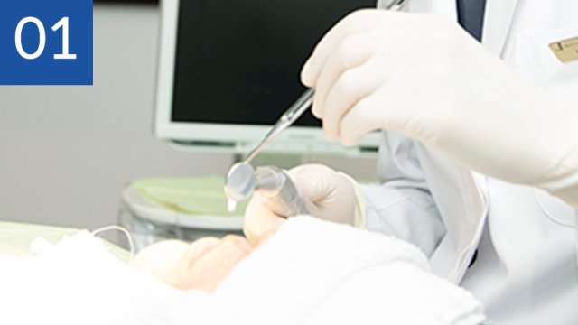 インプラント施術実績 累計36,418本